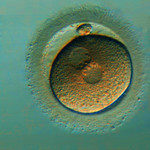 Zapłodniona komórka jajowa - zdjęcie z prawem do publikacji autor Przychodnia nOvum.jpg